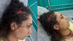 Adana’da bakkala giden kadın sokak köpeklerinin saldırısında yaralandı