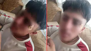 Öğretmenin kafa attığı 16 yaşındaki çocuğun burnu kırıldı