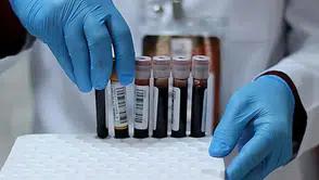 Kan grubunuz sağlığınızı tehdit ediyor mu? Bu 3 kan grubunda kanser riski %55 daha fazla