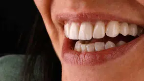 Ramazan Ayında Ağız Bakımında Dikkat Edilmesi Gerekenler Neler?