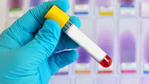 Alzheimer riskini öngören yeni bir kan testi yolda! Tam olarak ne zaman hazır olacak?