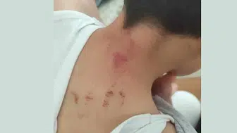 Şanlıurfa’da öğrenciyi darbeden öğretmen tutuklandı