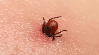 Kene ısırığında hayat kurtaran ilk adım