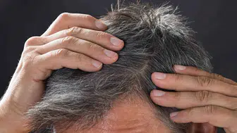 Beyaz saç kopardıkça çoğalır mı? Gerçek sandığınız gibi değil!