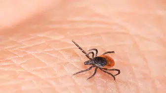 Kene vakaları Meclis gündeminde