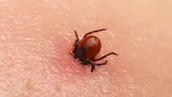 Parkta oynayan 3 yaşındaki kızın kulağına kene yapıştı