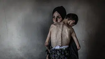 Gazze’de açlıktan ölümler durmuyor: Son 24 saatte 8 kişi daha yaşamını yitirdi