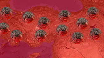 Türkiye'de Kanser Oranları Neden Bu Kadar Yüksek? TÜİK Verileri Açıkladı