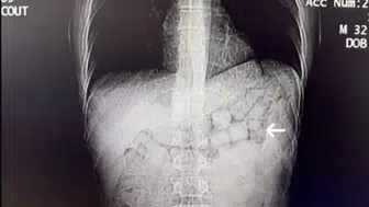 Diyarbakır’da midede uyuşturucu sevkiyatı: 2 kişi tutuklandı!