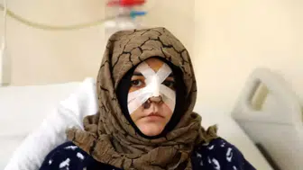 Kaldırım taşıyla öldüresiye darp etti!