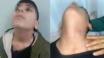 Kadın memur, 10 yaşındaki öğrencinin boğazını sıktı