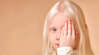 28 Şubat Dünya Nadir Hastalıklar Günü : DMD Aileleri Derneği'nden kamu destekli fon çağrısı