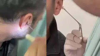 Kayseri'de bir kişi, kulağına gizlediği uyuşturucuyla yakalandı