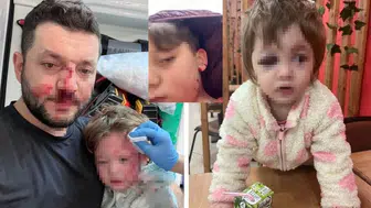 14 aylık bebeğe saldırmışlardı , şimdi de oğluna taş attılar