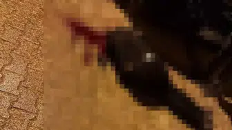 Şırnak Cizre’de sokakta yürürken tabanca ile başından vuruldu