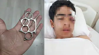 'Bana şaka yapma' dedi, hayatı karardı ! Esenyurt'ta 15 yaşındaki çocuğa muştalı saldırı