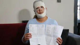 Adana'da güzellik merkezi faciası : Kadının yüzünde yanıklar oluştu