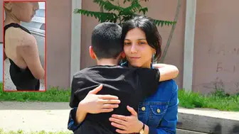 Babasının darbettiği çocuk devlet korumasına alındı
