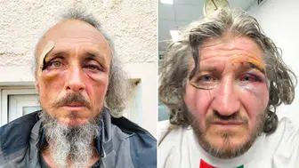 İsrail'den yardım filosuna saldırı: 31 yaralı