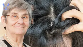 Saç diplerinde bitmek bilmeyen kaşıntıya kesin çözüm! Canan Karatay'dan gizli formül
