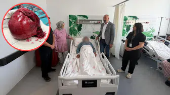 Niğde'de hastanın vücudundaki 7 kiloluk tümör başarıyla çıkarıldı