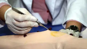 Yozgat'ta kenenin tutunduğu çocuk hayatı kaybetti