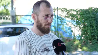Arnavutköy'de canlı yayın sırasında saldırıya uğradı