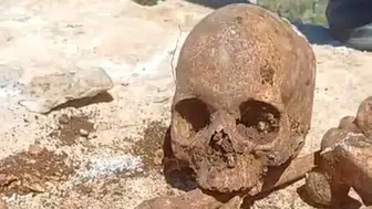 Malatya'da kazı sırasında insan kemikleri ve kafatası parçası bulundu