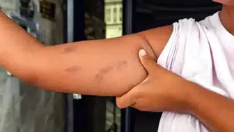 Adana'da babaannesine selam verdi, amcasının saldırısına uğradı