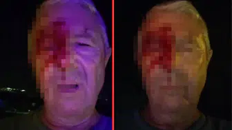 Kocaeli'de 2 kişinin saldırısına uğrayan muhabir kanlar içinde kaldı