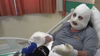 Evladını alevlerin arasından kurtaran annenin tedavisi sürüyor