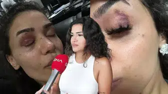 "Ölmeden önce sesimi duyun"