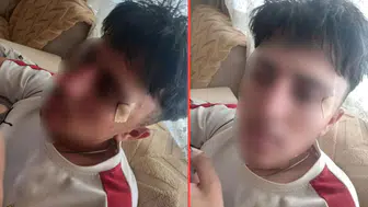 Öğretmenin kafa attığı 16 yaşındaki çocuğun burnu kırıldı