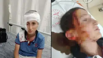 İzmir'de köpek saldırısına uğrayan çocuğa  tazminat