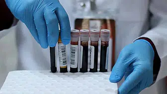 Kan grubunuz sağlığınızı tehdit ediyor mu? Bu 3 kan grubunda kanser riski %55 daha fazla