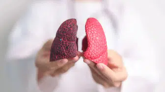 Zatürre Belirtileri Nedir? Zatürre Neden Olur?
