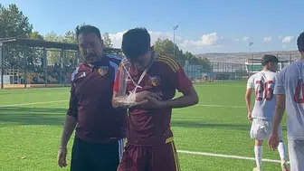 Kayserispor U19'da Hilmi Türkan Sakatlık Şoku Yaşadı