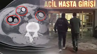 Bitlis'te Yolcu Otobüsünde Midesinden 758 Gram Metamfetamin Çıktı