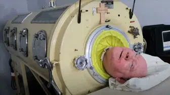 Paul Alexander kimdir, kaç yaşında, neden öldü ve hastalığı neydi?