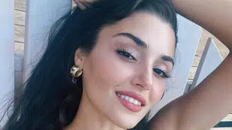 Hande Erçel'in yüzüne ne oldu? Hande Erçel estetik mi yaptırdı?