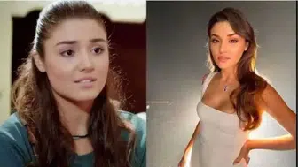 Estetik Operasyonlarla Görünümünü Değiştiren Türk Ünlüler Kimlerdir?