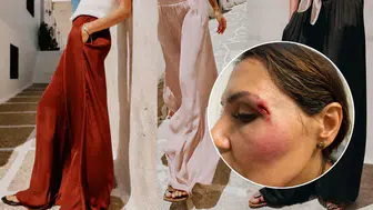 Ölüm pantolonundan nefessiz bırakan korselere : Moda tarihinin tehlikeli yüzü