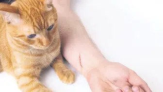 Kedi , köpek ısırıkları ve çiziklerinde dikkat edilmesi gerekenler neler?