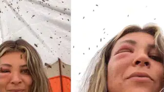 Arılarıyla yakın bağ kurmaya çalışan kadın, beklenmedik bir saldırıya uğradı