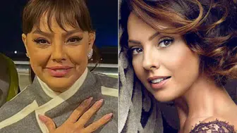 Ebru Gündeş'in estetik operasyonu sonrası görünümü nasıl?