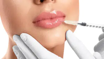 Dudak dolgusu tamamen eriyor mu? Kalıcılığı ne kadar, dolgu ne zaman kaybolur?