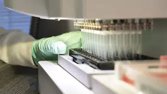 Yeni ultrason teknolojisi ile en agresif beyin tümörü nasıl canlı olarak izlenebilir ?