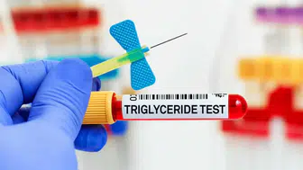 Trigliserit seviyeleri nasıl düşürülür ? Trigliserit nedir ?