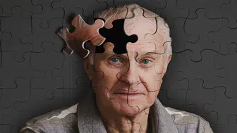 Alzheimer hastalarının sosyal hayatta kalması neden önemli ?