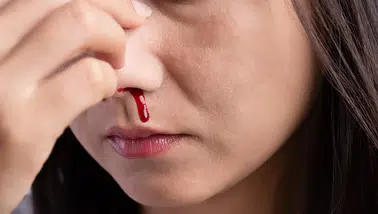 Burun kanaması orucu bozar mı? Diyanet'e göre burundan kan gelince oruç bozulur mu?